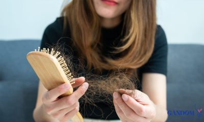 علت ریزش مو